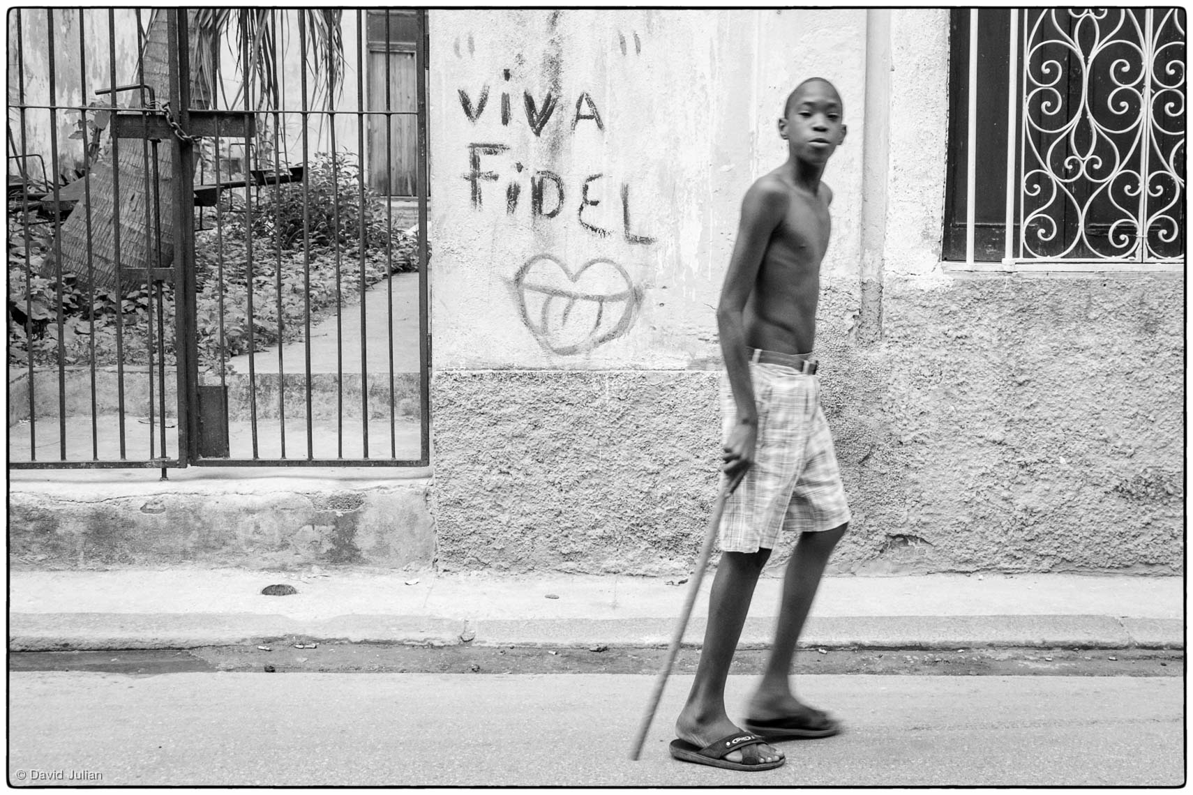 25_Cuba_Havana-injured-boy-5754